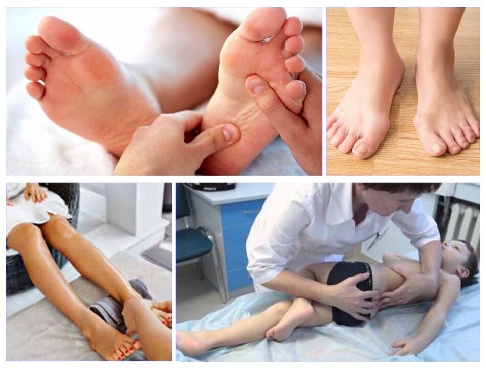 Peripheral deformation in children's treatment
