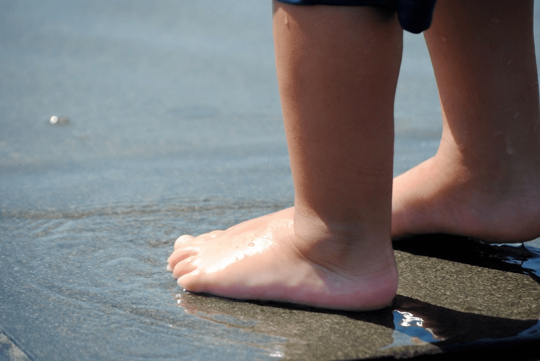Prevent varicose
