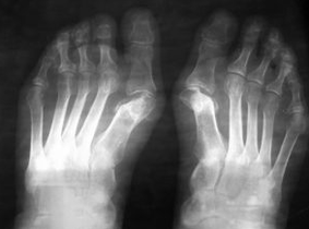 Instructions for operating under the flip of the foot