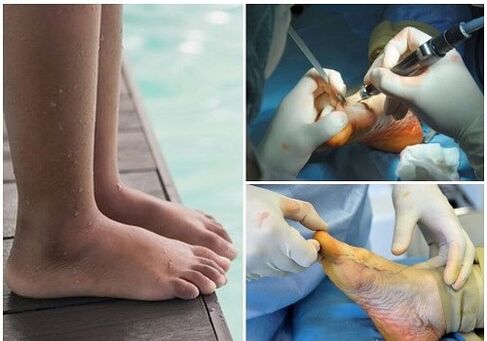 Small surgical treatment