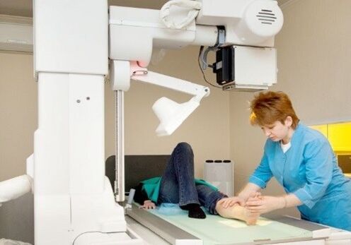X-ray legs